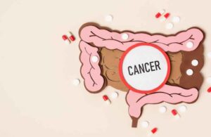 Détecter les signes avant-coureurs du cancer du côlon : les trois indicateurs clés